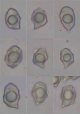 Sporen von Entoloma chalybaeum