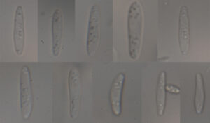 mehrere Abbildungen der Sporen von Roseodiscus formosus